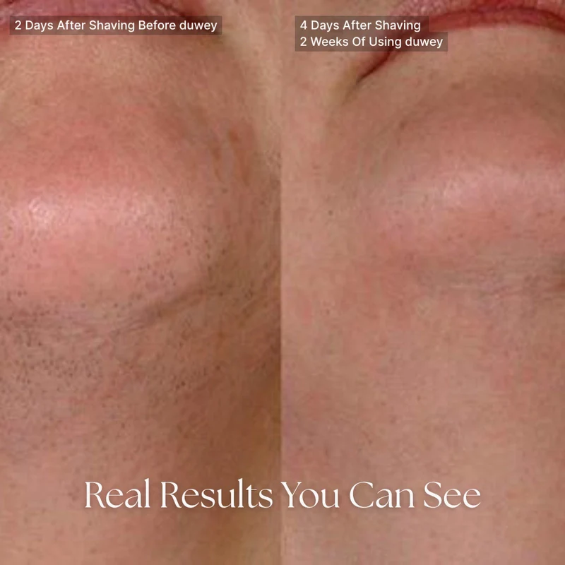 Recuvia™ Cyperus Rotundus Oil - Achieve Lasting Smoothness! - Image 11