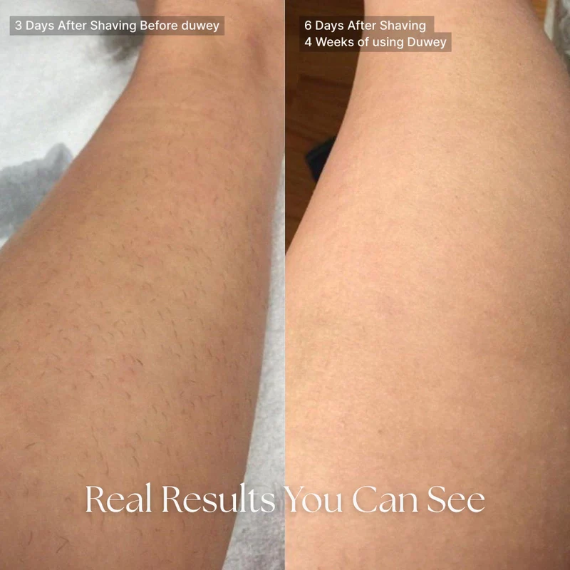 Recuvia™ Cyperus Rotundus Oil - Achieve Lasting Smoothness! - Image 12