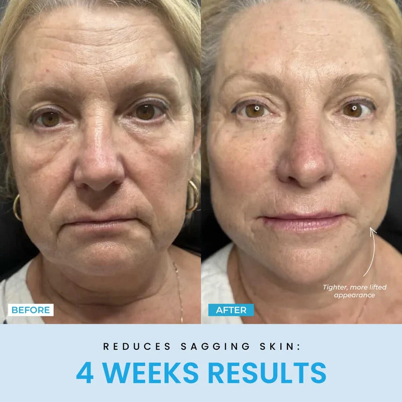 Recuvia™ Lymphatic Drainage Body Sculptor - Image 11