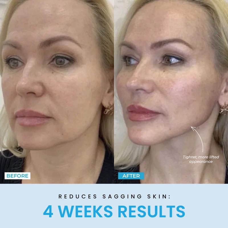 Recuvia™ Lymphatic Drainage Body Sculptor - Image 12