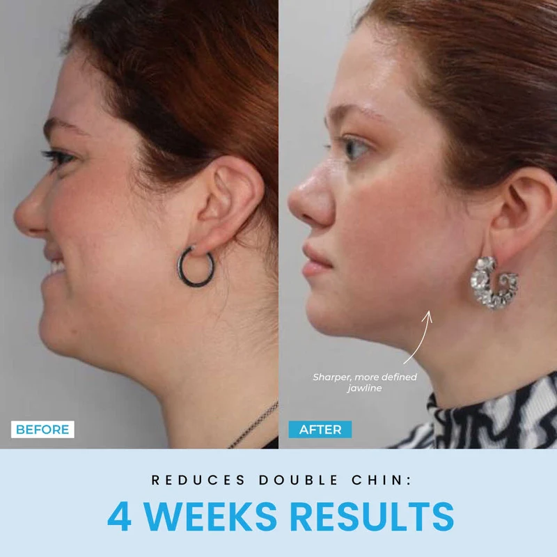 Recuvia™ Lymphatic Drainage Body Sculptor - Image 4