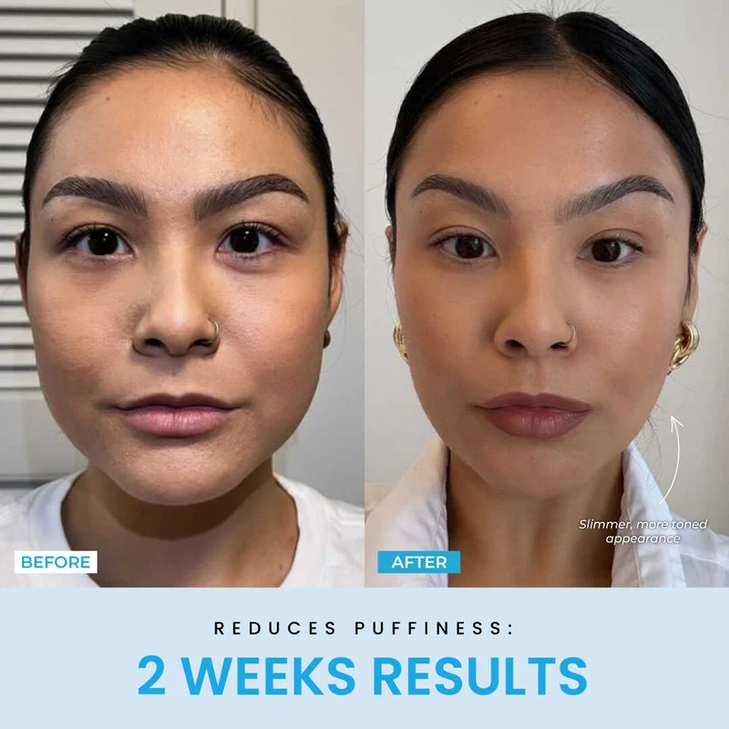 Recuvia™ Lymphatic Drainage Body Sculptor - Image 6