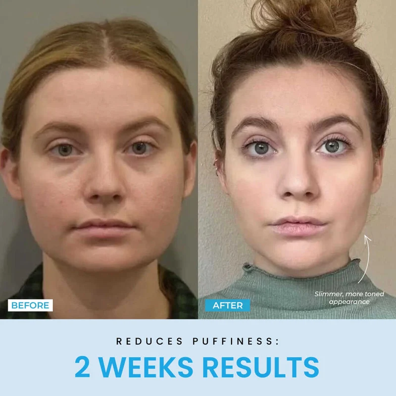 Recuvia™ Lymphatic Drainage Body Sculptor - Image 8