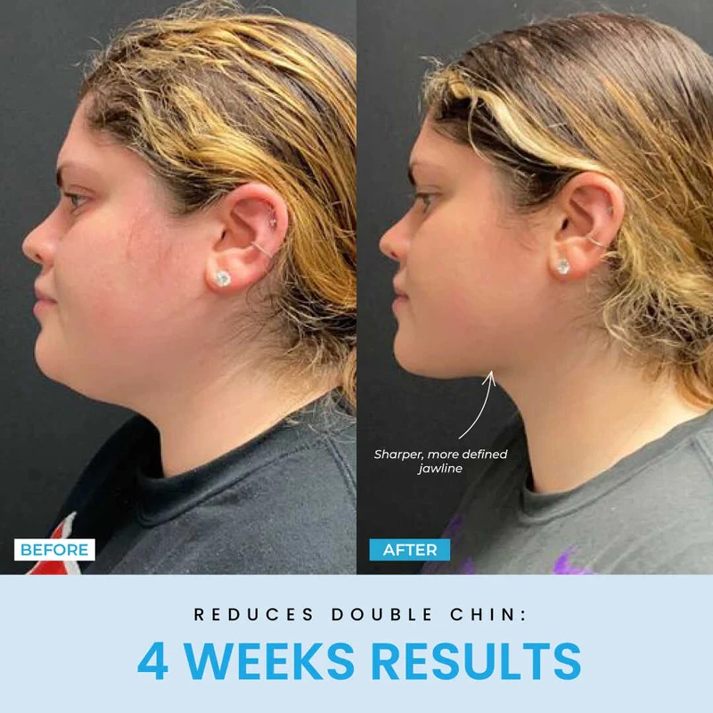 Recuvia™ Lymphatic Drainage Body Sculptor - Image 9