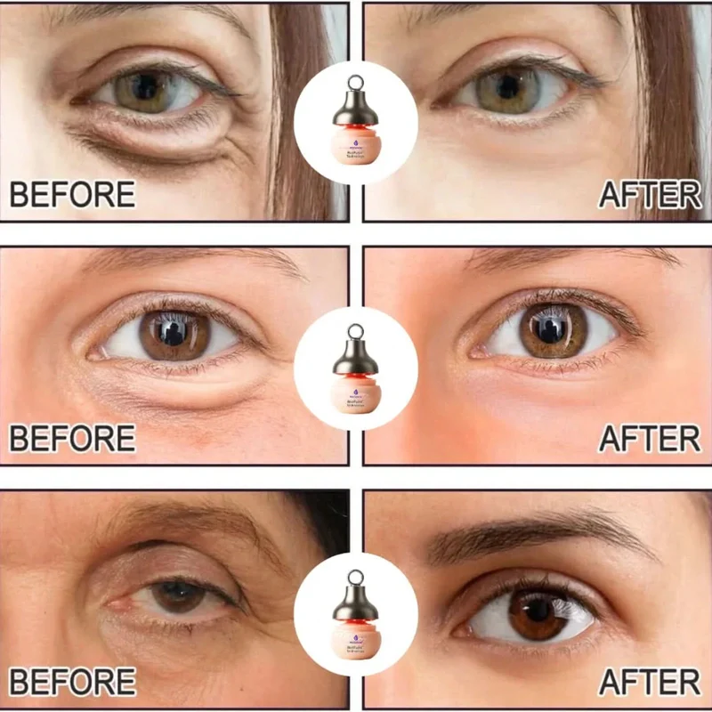 Recuvia™ - Revitalize Your Eyes Instantly! - Image 5
